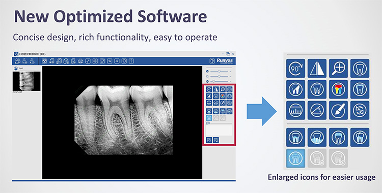 XR44B Digital Intraoral Sensor